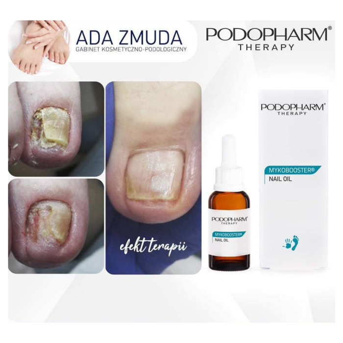 MYKOBOOSTER® Nail Oil 20ml